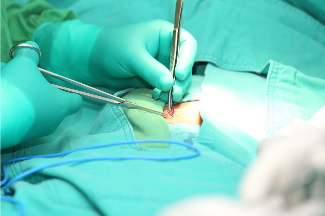 hernia inguinal