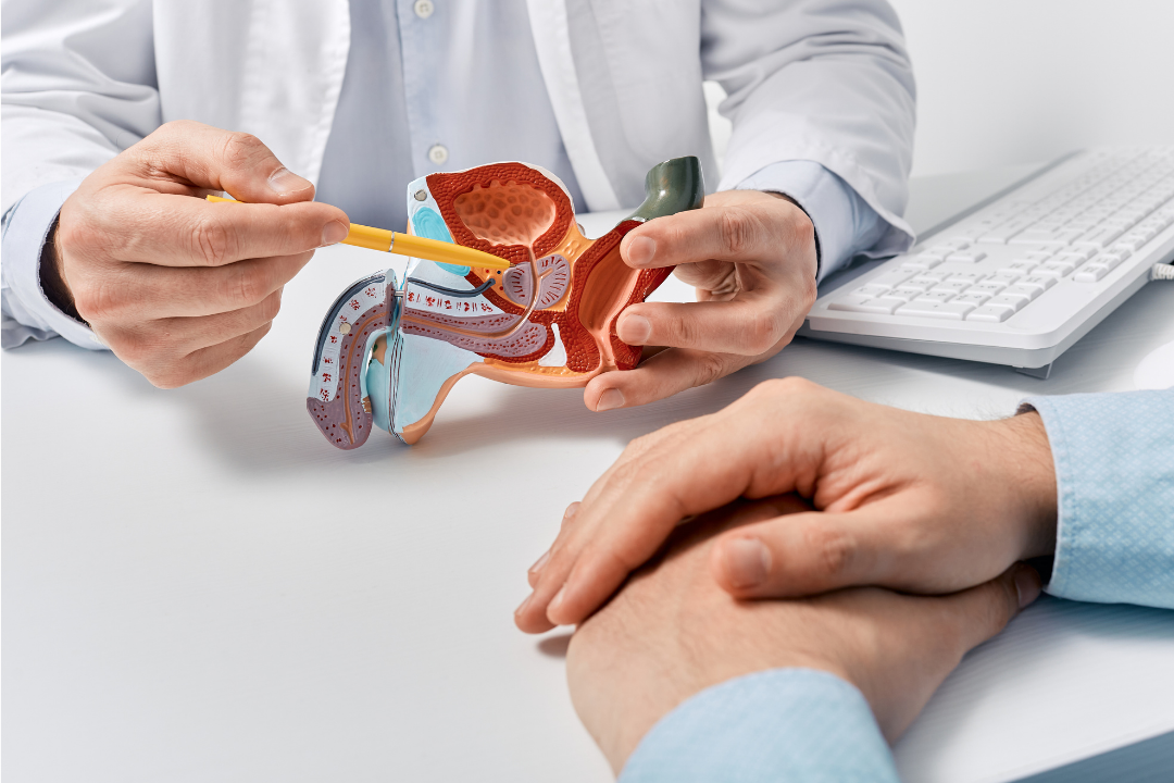 prostatectomia